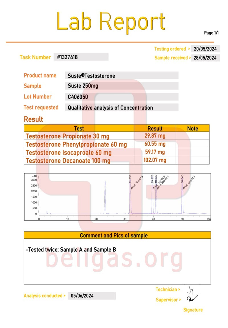 Labtest for Beligas Suste-Testosterone